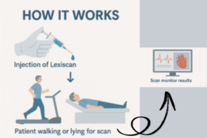 How the Lexiscan Stress Test Works