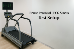 Bruce Protocol treadmill with ECG monitor for clinical stress testing